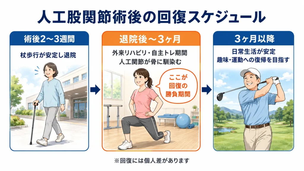 人工股関節術後の回復スケジュール。術後2〜3週間で退院、退院後〜3ヶ月が回復の勝負期間、3ヶ月以降に趣味復帰を目指す流れを解説した図解
